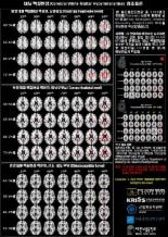 뇌경색 위험 예측지도, 내 뇌는 몇 등? ‘한국인 허혈 뇌지도’ 완성