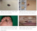 '감옥으로부터의 사색' 신영복 교수 사망원인, 악성 흑색종이란