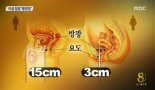 방광염 생활습관, 증상은?…‘요도+아랫배 통증’ “매일 7~8컵 물 섭취 중요”