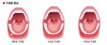 [yes+ Health] 웃고 있어도 눈물이 난다 ㅠ.ㅠ