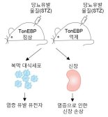 당뇨병성 신증 원인 유전자 찾았다...발병 억제제 개발 중