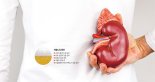 [yes+ Health] 거품 소변 그냥 두면 안돼요