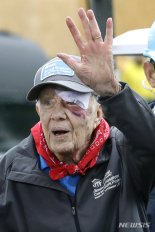 95세 지미 카터, 이마 14바늘 꿰매고도 봉사활동 참가
