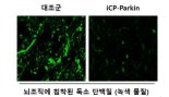 셀리버리, 파킨슨병 치료신약 국제특허 연이어 획득...日제약사와 라이선싱 아웃 탄력