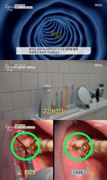‘MBC 생방송 오늘아침’ 등장한 구강세정기는? 치주포켓 케어로 호흡기 질환 예방