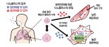 나노플라스틱이 폐세포를 60분만에 파괴