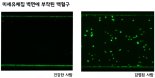 병원균 감염을 10분만에 피 한 방울로 알아낸다