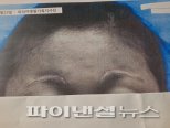 [단독] 성형 부작용 7년째 1인소송 주부··· 의사 '유죄' [김기자의 토요일]