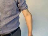 이재명, '군 미필' 공세에 '굽은 왼팔' 공개로 정면 대응