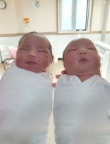 일란성 쌍둥이 9~15% 발생한다는 이 병