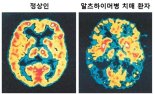 셀리버리, 치매극복연구개발 국책사업에 치매치료제 신약개발 과제 선정