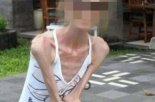 키 165cm 몸무게 25kg...뼈만 남았는데 다이어트 하겠다는 중국 여성