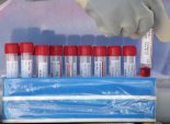 코로나19 과학적 대응 기반 '항체양성률' 조사 9월초 발표