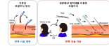 모낭없이 머리카락 심는다..카이스트, 와인으로 강력 접착제 개발