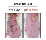 셀리버리 "iCP-NI, 아토피 치료제로 L/O 추진...데이터패키지 송부"