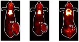 대장암 18일만에 80% 없앴다… 암치료용 나노물질 개발