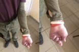 우크라 파병 러 용병 300명 손목에 '붉은 밴드'...에이즈 감염자였다