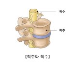 "주먹 쥐었다 펴는 것 어렵다" 뇌졸중 아닌 이병 의심