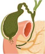 '기름진 추석음식' 먹고 복통 있으면..이 병 의심