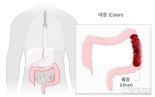 "변 평소보다 가늘다" 이 병 아닌가 의심