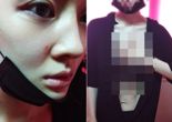 "옷 찢고 피멍" 티아라 출신 아름, 전 남편 폭행 주장 사진 공개