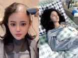 中 '인형 외모' 여성, 항암 포기…치료 중단 왜 [헬스톡]