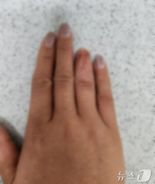 “도끼로 손가락을…” 고의로 신체 훼손, 보험금 타낸 외노자들 딱 걸렸다