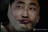 BBC "우크라 전쟁 파병 북한군, 1000명 사망"