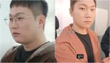 빠니보틀, '이 주사' 맞고 10㎏ 감량…날렵해진 턱선 '깜짝' [건강잇슈]