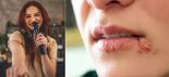 "노래방 마이크, 커버 없이 썼다가..8년째 고통받는다"는 30대女, 무슨 일? [헬스톡]