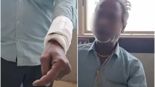 다친 아들 따라온 60대父..손 잘못 들었다 손 절개 수술받아 '황당'