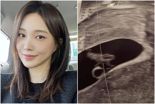서민재 "임신 9주차…남친 연락두절, 아버지로서 책임 다하길"