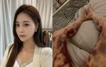 아옳이 '전신 피멍' 소송 4년 만에 승소…법원 "허위사실 아니다"