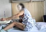 결혼식 앞두고 개에 물려 전치 3주..견주 "뼈라도 부러졌냐" 뻔뻔 [어떻게 생각하세요]