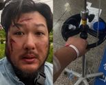 "40도 고열지속, 신장도 망가졌다"..투병 근황 알린 김대호, 무슨 일? ​[헬스톡]