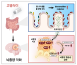 "짠 음식, 뇌종양도 악화" 세계 첫 원인규명