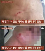 길가에 배달오토바이 발로 차더니, 기사까지 폭행한 男... CCTV 보니