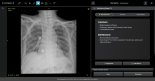 딥노이드, 생성형 AI ‘M4CXR’ 식약처 임상시험계획 승인 “의료AI 솔루션 상용화↑”