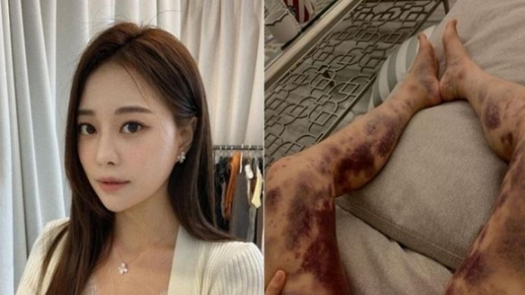 헉스기사