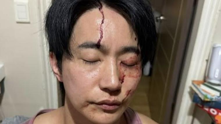 헉스기사