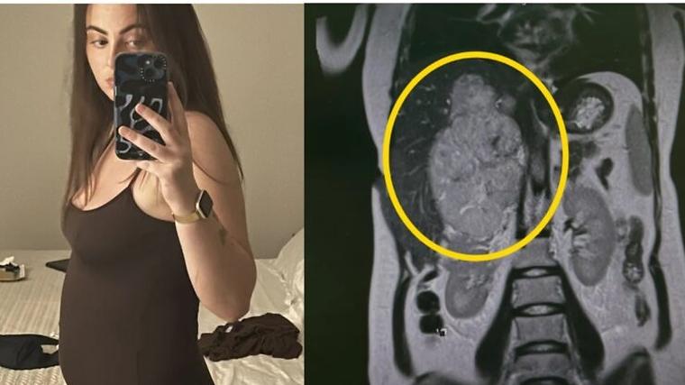 헉스기사