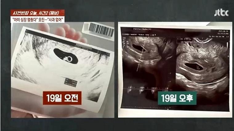 헉스기사