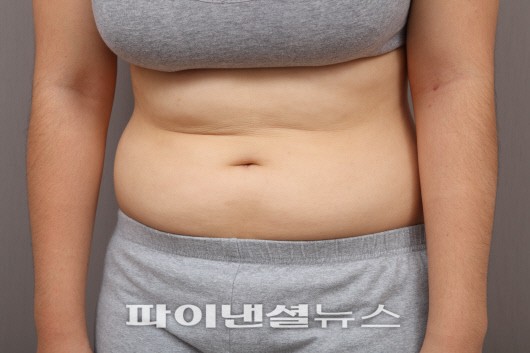 ‘1일 1식’ 다이어트 열풍.. 살 빠질까?