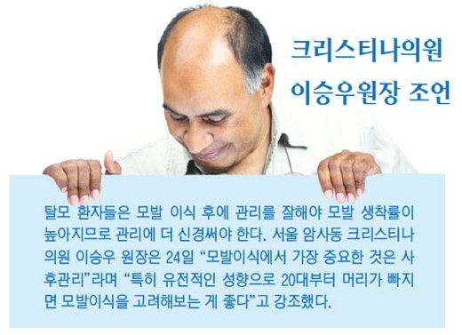 20대 탈모, 유전이면 모발이식 고려해야