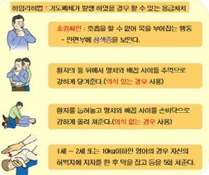 떡 먹다 목에 걸렸을 때 알아둬야 할 ‘하임리히법’