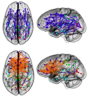 남자의 뇌(위)와 여자의 뇌(아래) / 이미지출처=비즈니스인사이더