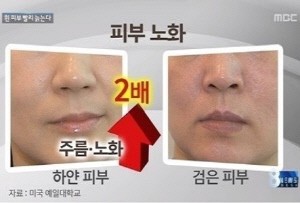 피부노화의 원인, 환경적 요인과 내인성노화가 문제 - 파이낸셜뉴스