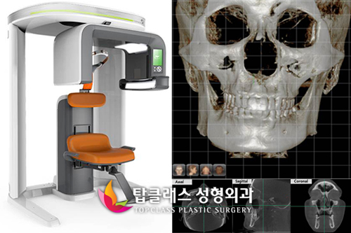 안면윤곽수술, 최첨단 3D CT로 정확한 수술계획 가능