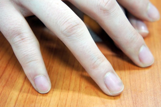 손톱, 아름답고 건강하게 관리하는 법