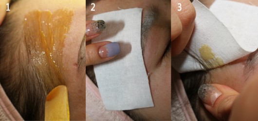 연예인처럼 동그란 이마 만들어주는 헤어라인 왁싱 노하우